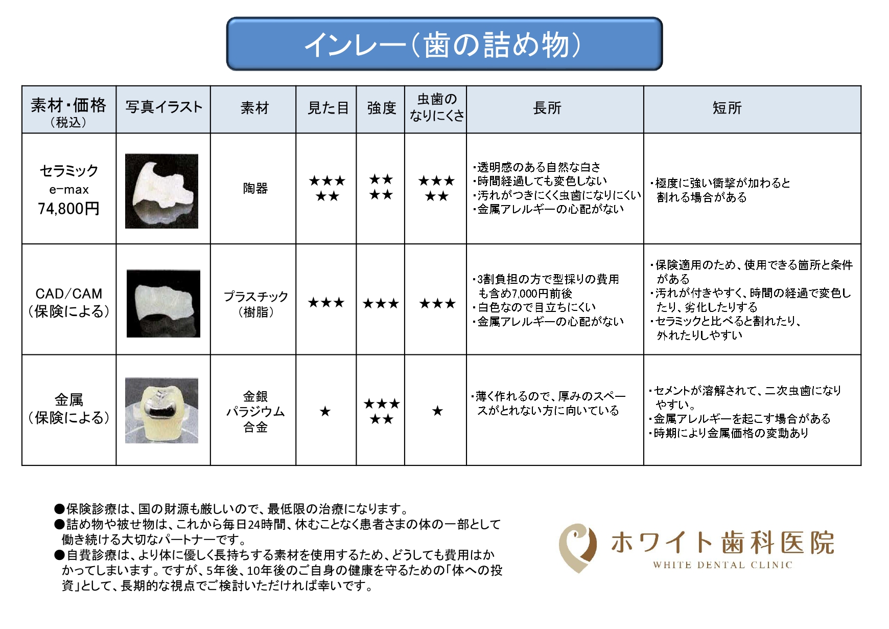 インレー（歯の詰め物）