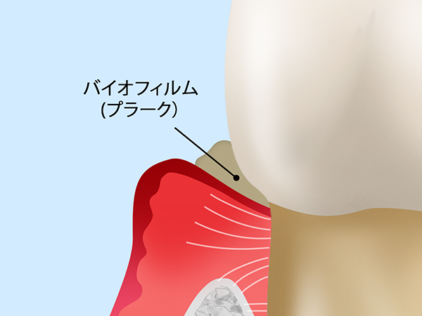 初期